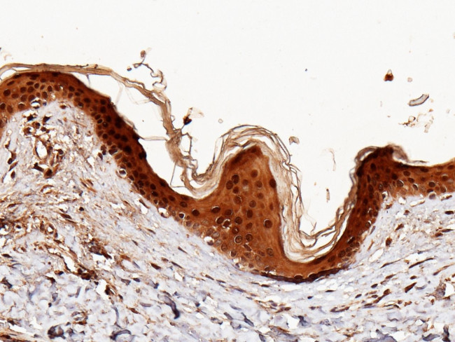 Caspase 14 Antibody in Immunohistochemistry (Paraffin) (IHC (P))