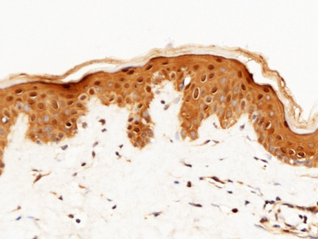 Caspase 14 Antibody in Immunohistochemistry (Paraffin) (IHC (P))