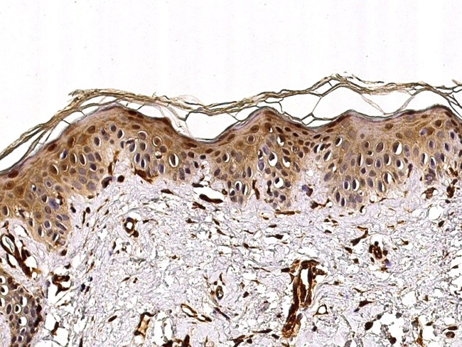 Caspase 14 Antibody in Immunohistochemistry (Paraffin) (IHC (P))