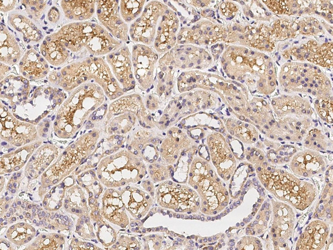 CD200 Antibody in Immunohistochemistry (Paraffin) (IHC (P))