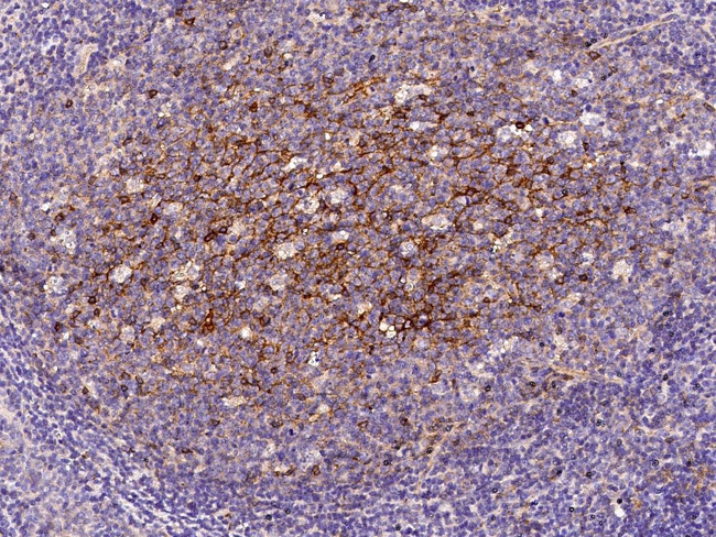 CD200 Antibody in Immunohistochemistry (Paraffin) (IHC (P))