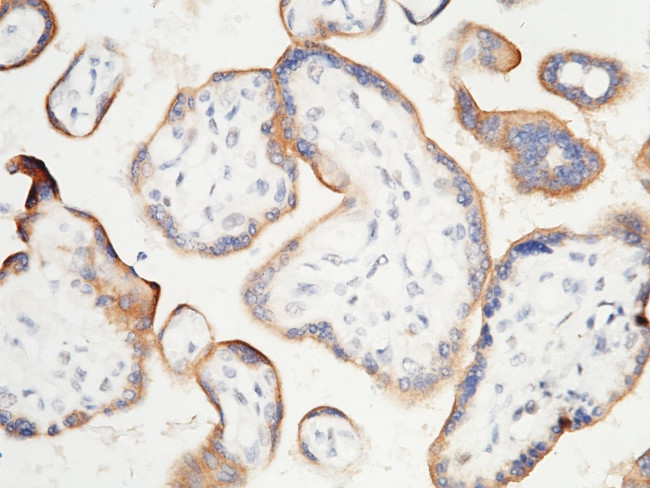 PD-L1 Antibody in Immunohistochemistry (Paraffin) (IHC (P))