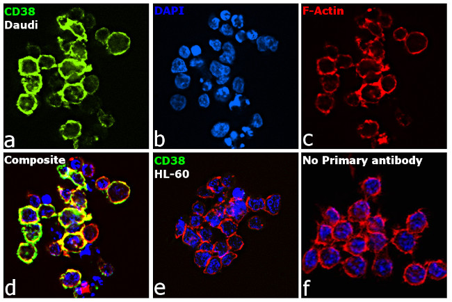 CD38 Antibody in Immunocytochemistry (ICC/IF)