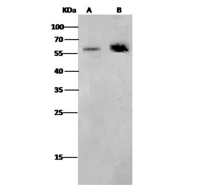 CD4 Antibody in Western Blot (WB)