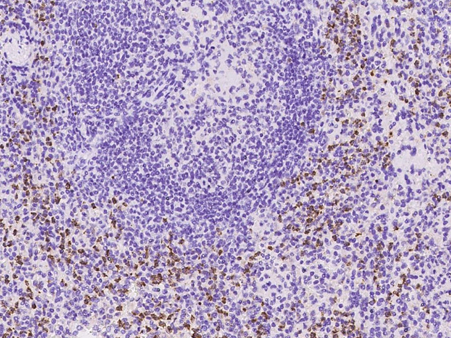 CD4 Antibody in Immunohistochemistry (Paraffin) (IHC (P))