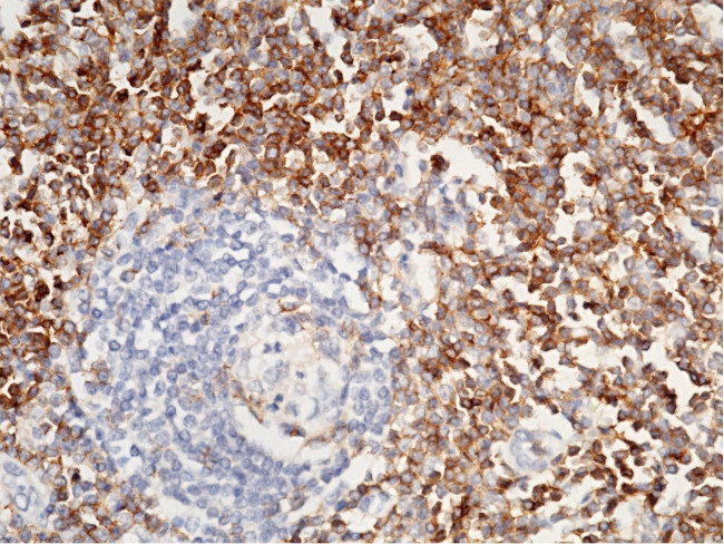 CD4 Antibody in Immunohistochemistry (Paraffin) (IHC (P))