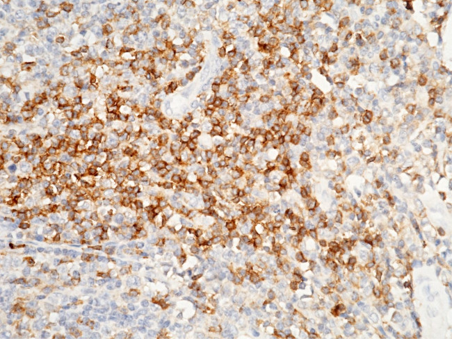 CD4 Antibody in Immunohistochemistry (Paraffin) (IHC (P))