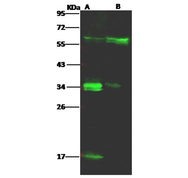 CD58 Antibody in Western Blot (WB)