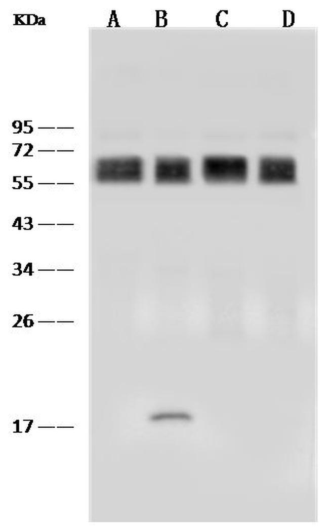 CD58 Antibody in Western Blot (WB)