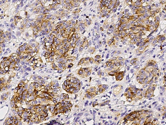 CD63 Antibody in Immunohistochemistry (Paraffin) (IHC (P))