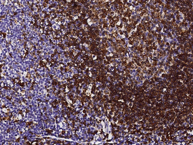 CD74 Antibody in Immunohistochemistry (Paraffin) (IHC (P))