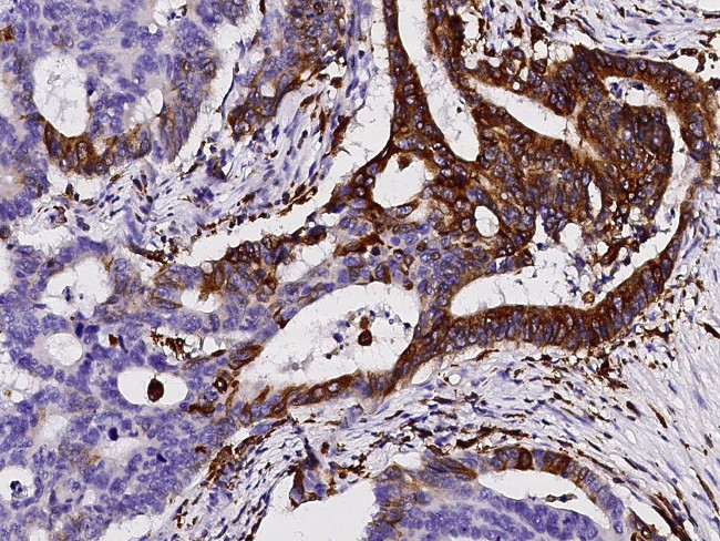 CD74 Antibody in Immunohistochemistry (Paraffin) (IHC (P))