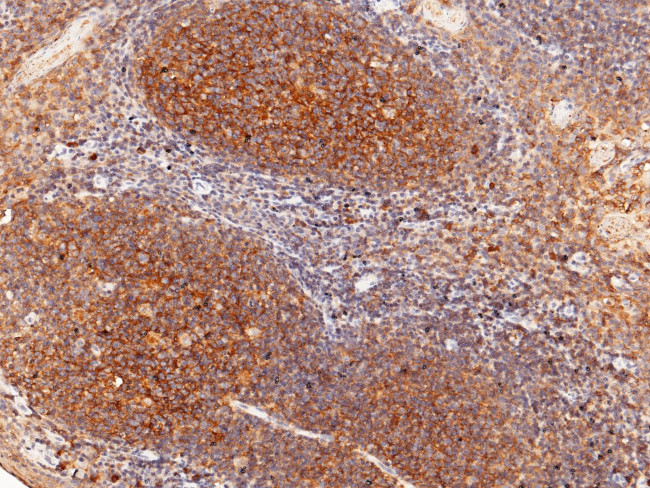 CD82 Antibody in Immunohistochemistry (Paraffin) (IHC (P))