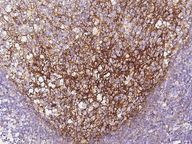 CD82 Antibody in Immunohistochemistry (Paraffin) (IHC (P))