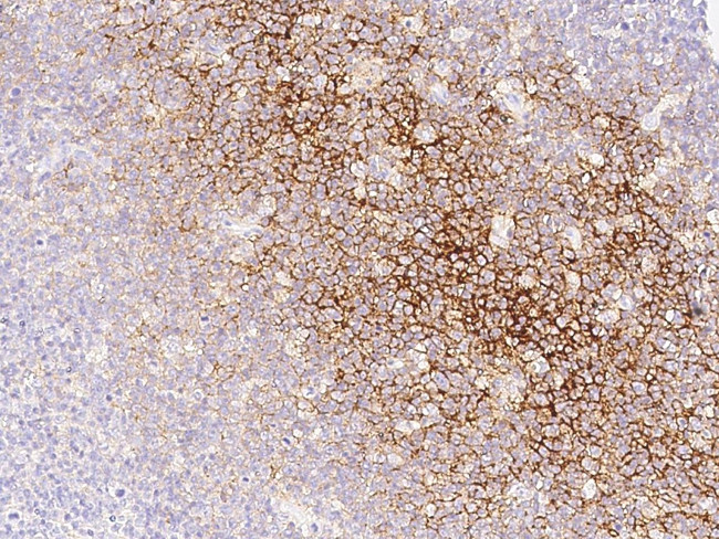 CD82 Antibody in Immunohistochemistry (Paraffin) (IHC (P))