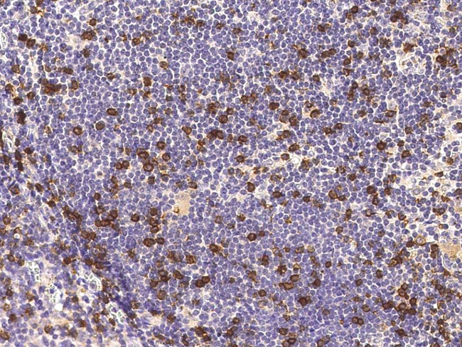 CD8 beta Antibody in Immunohistochemistry (Paraffin) (IHC (P))