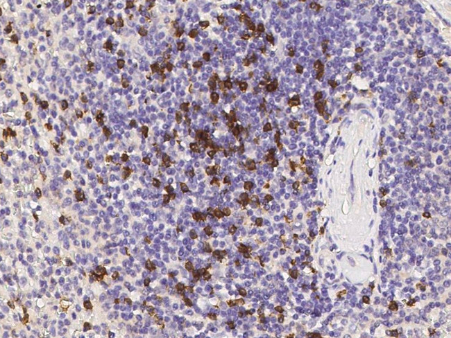 CD8 beta Antibody in Immunohistochemistry (Paraffin) (IHC (P))