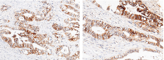 CDH17 Antibody in Immunohistochemistry (Paraffin) (IHC (P))