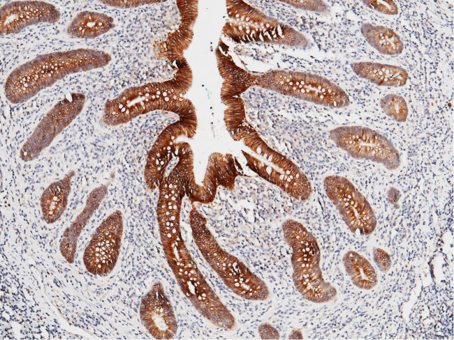 CDH17 Antibody in Immunohistochemistry (Paraffin) (IHC (P))