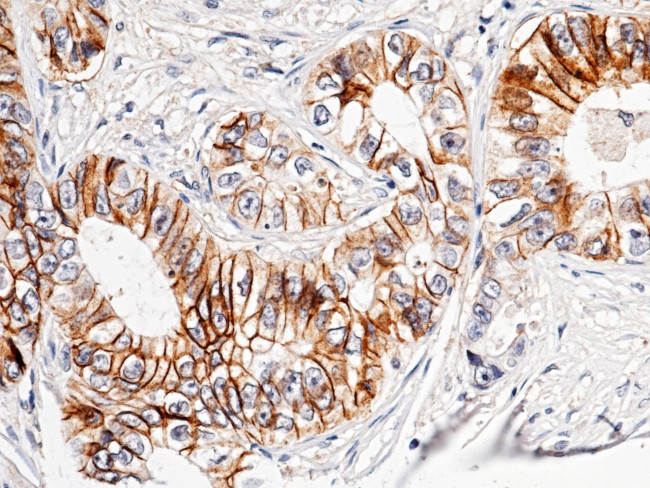 CDH17 Antibody in Immunohistochemistry (Paraffin) (IHC (P))