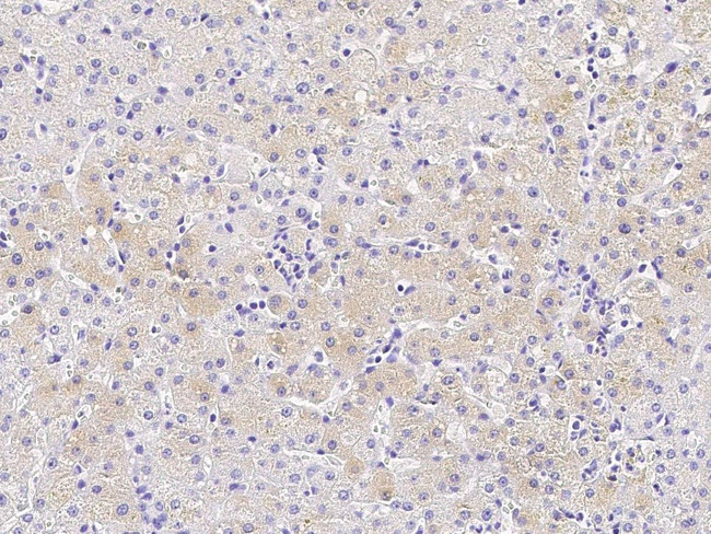 CES3 Antibody in Immunohistochemistry (Paraffin) (IHC (P))