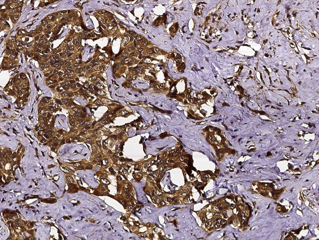 CHI3L2 Antibody in Immunohistochemistry (Paraffin) (IHC (P))