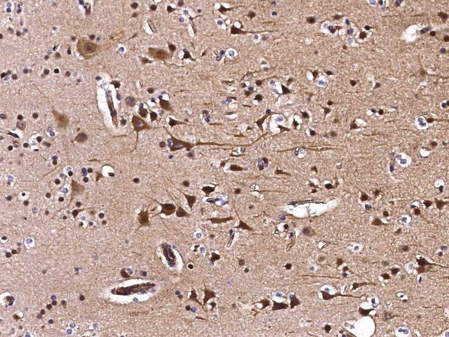 KIP2 Antibody in Immunohistochemistry (Paraffin) (IHC (P))