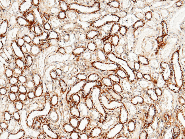 Tetranectin Antibody in Immunohistochemistry (Paraffin) (IHC (P))