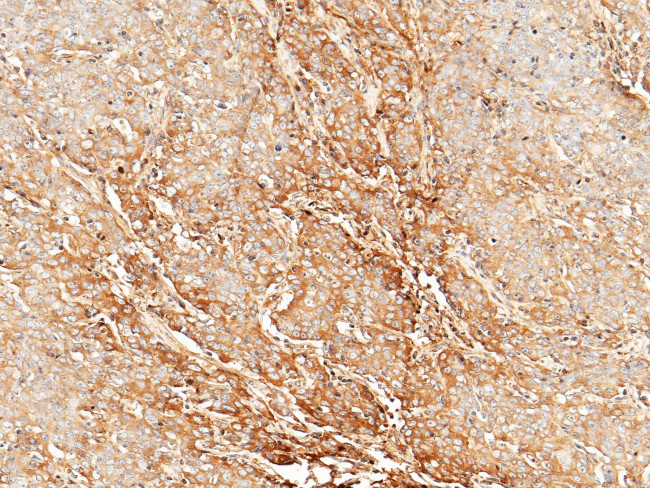 Tetranectin Antibody in Immunohistochemistry (Paraffin) (IHC (P))