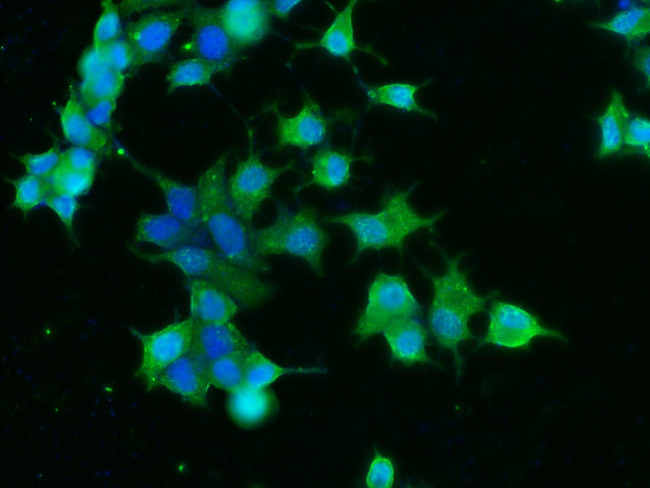 CNDP1 Antibody in Immunocytochemistry (ICC/IF)