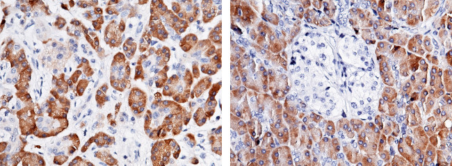 Carboxypeptidase A2 Antibody in Immunohistochemistry (Paraffin) (IHC (P))