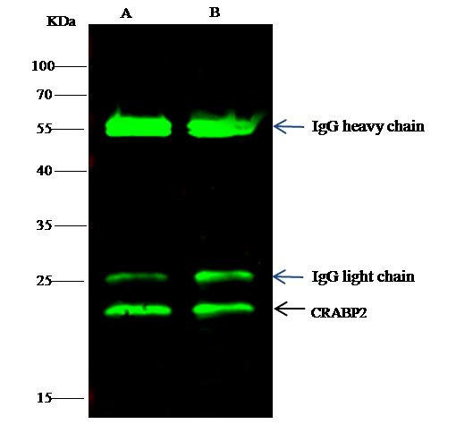 CRABP2 Antibody in Immunoprecipitation (IP)