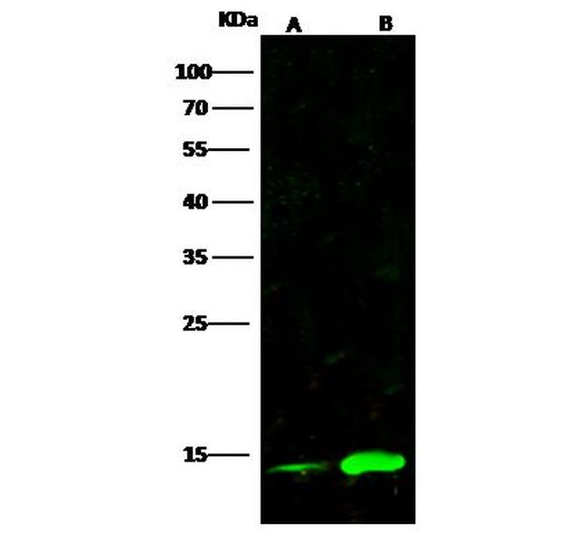 CRABP2 Antibody in Western Blot (WB)