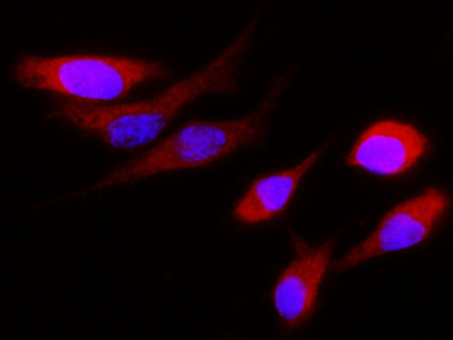 Cystatin S Antibody in Immunocytochemistry (ICC/IF)