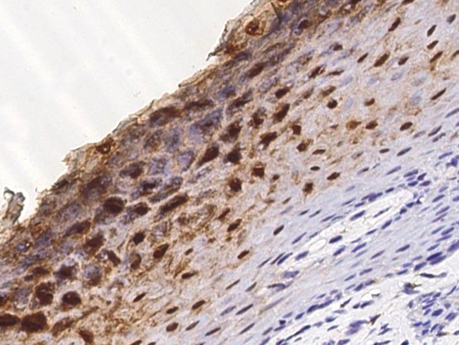 Cystatin A Antibody in Immunohistochemistry (Paraffin) (IHC (P))