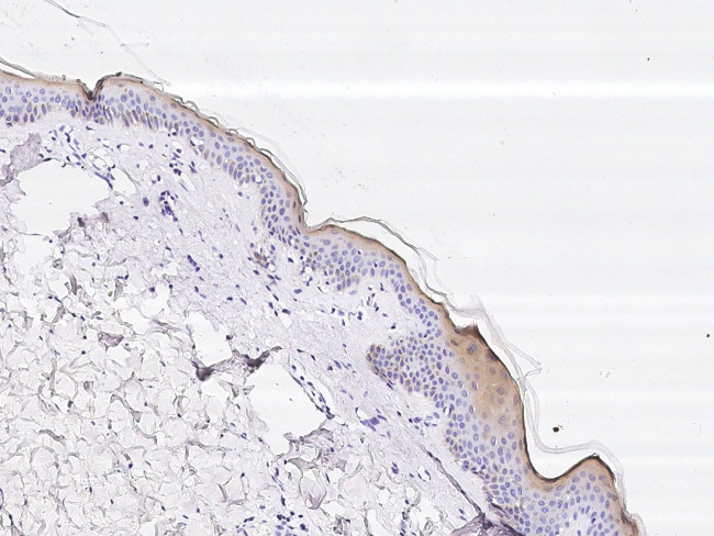 Cystatin A Antibody in Immunohistochemistry (Paraffin) (IHC (P))