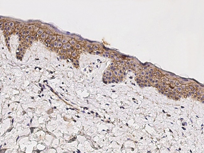 beta Catenin Antibody in Immunohistochemistry (Paraffin) (IHC (P))