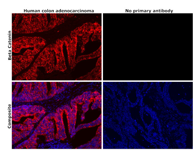 beta Catenin Antibody in Immunohistochemistry (Paraffin) (IHC (P))