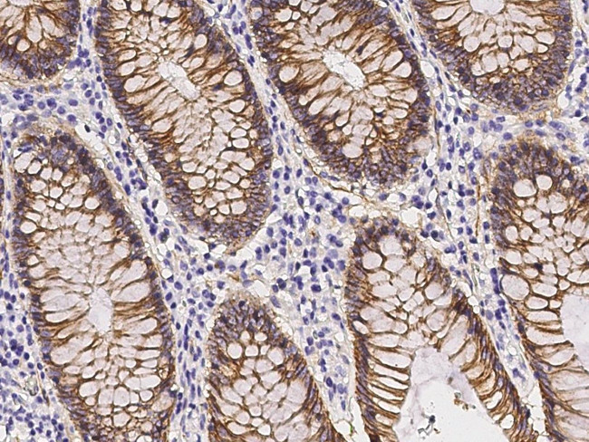 beta Catenin Antibody in Immunohistochemistry (Paraffin) (IHC (P))