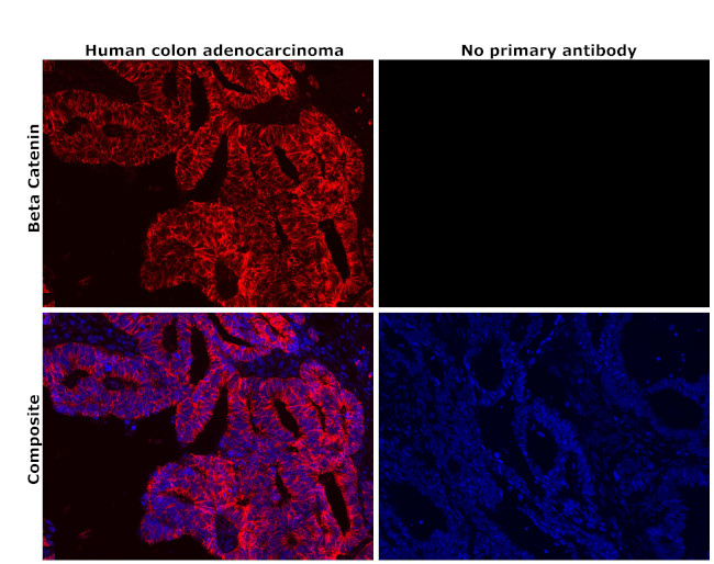 beta Catenin Antibody in Immunohistochemistry (Paraffin) (IHC (P))