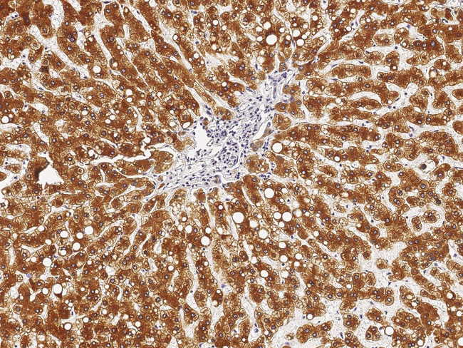 Cathepsin D Antibody in Immunohistochemistry (Paraffin) (IHC (P))