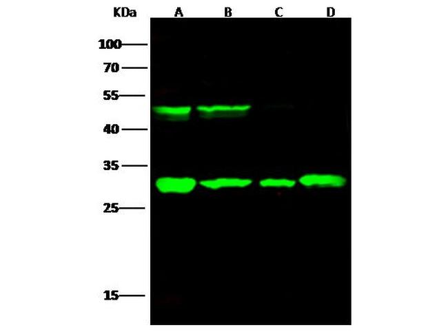 Cathepsin D Antibody in Western Blot (WB)