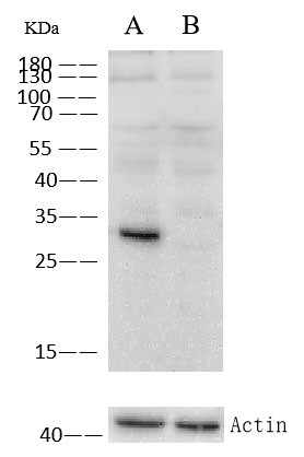 Cathepsin D Antibody in Western Blot (WB)