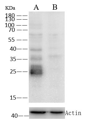 Cathepsin L Antibody in Western Blot (WB)