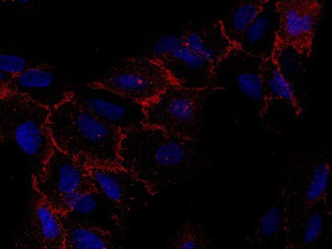 CAR Antibody in Immunocytochemistry (ICC/IF)