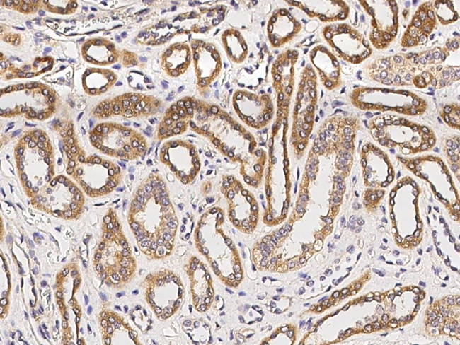 CXCL11 Antibody in Immunohistochemistry (Paraffin) (IHC (P))