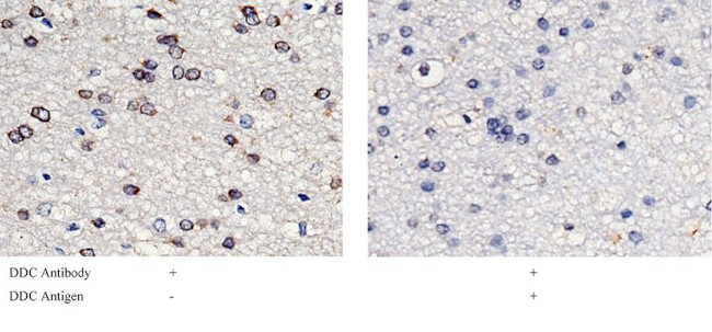 DOPA Decarboxylase Antibody in Immunohistochemistry (Paraffin) (IHC (P))