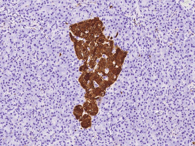 NSE Antibody in Immunohistochemistry (Paraffin) (IHC (P))