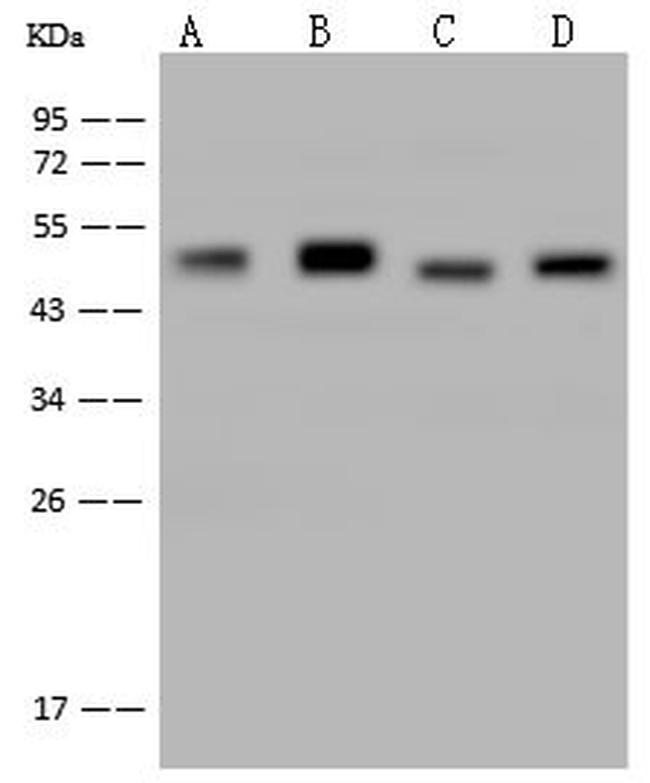 NSE Antibody in Western Blot (WB)