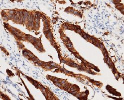 EpCAM Antibody in Immunohistochemistry (Paraffin) (IHC (P))